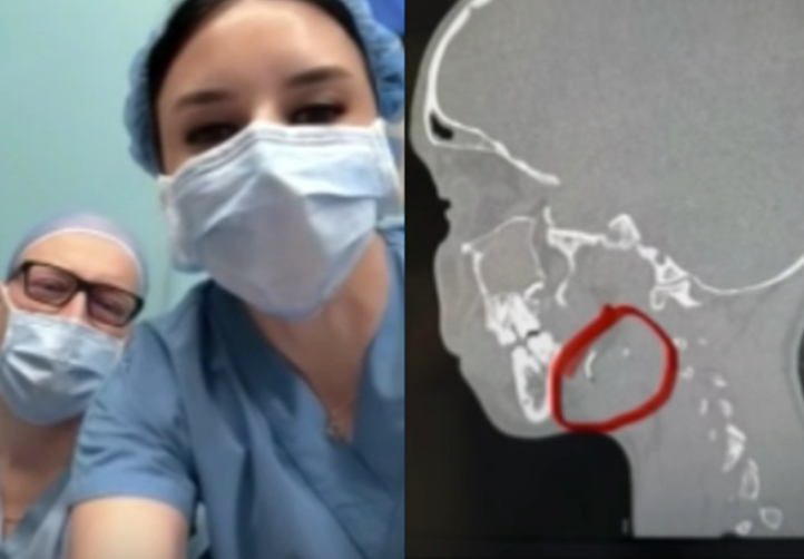 “12 წლის გოგონა 9 წელი ცხოვრობდა ყბა-სახსარში ჩატეხილი ნემსით…” – რა კადრებს აქვეყნებს მედეა იობაშვილი?